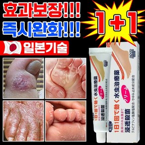 [빠른 배송] 1+1 일분 기술 발 무좀약 발가락 발바닥 가려움증 건선 제거 연고 발모래 발물집 탈피 습진 완화, 1세트, 20g