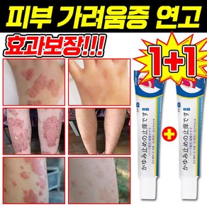 [일본 기술] 1+1/2+2 피부 가려움증 연고 건선 연고 치료제 습진 모낭염 연고 지루성 피부염 각종 피부 트러블 곰팡이균 볽은반점 완화 크림