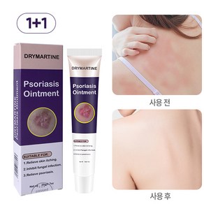 DRYMATYINE 건선 크림 습진크림 발진 가려움 두피건선 가려움완화