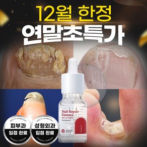 메디올가 네일 리페어 에센스, 15ml, 2개