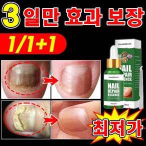 국내당일출고] 손톱 발톱 앰플 손발톱 영양제 네일 케어 문제성발톱 진균 발톱강화 관리 효과 짱, 1개, 30ml