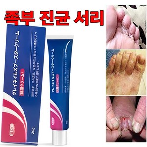 무좀 가려움증 무좀 천적 발바닥 족부 진균 서리, 1개, 20g