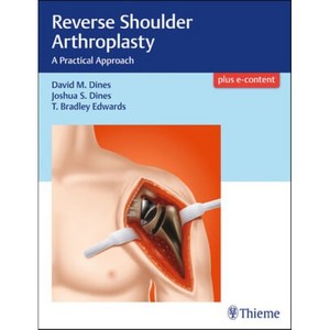 Revese Shoulde Athoplasty:A Pactical Appoach, Thieme Medical Publishes