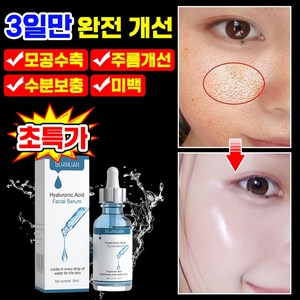 [피부과 추천] 1/1+1/2+2 저분자 히알루론산 앰플 원액 모공 수축 앰플 모공축소 에센스 주름개선 세럼 모공 리프팅 앰플 미백 보습, 1개, 30ml