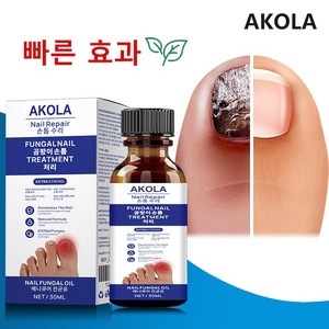 [속달 배송] 무좀 손발톱 건강 회복을 위한 큐티클케어 & 발톱 영양제 발가락 악취 제거 발톱 리페어 에센스 & 무좀 문제 해결, 2개, 10ml