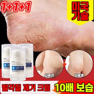 [당일배송] 1+1+1/1+1 바세린 발각질제거 크림 풋케어 스틱 발뒤꿈치 각질연화 보습 리페어 풋크림 30g, 1+1+1(3개), 3개, 1개입