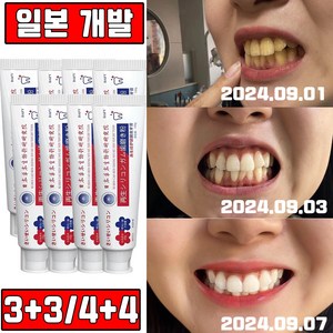 [치과추천] 일본 2+2/3+3 고불소 미백 치약 화이트닝 누렁니 구취제거 염증 예방 안심배송 증정, 6개, 120g