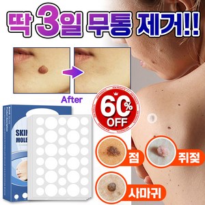 [빠른배송] 피부 제거 패치 얼굴 바디 피부 치료 라벨 스텔스, 1개, 145매입