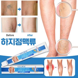 하지정맥류 크림 정맥류 연고 혈관염 다리부종 혈액순환 붓기크림 포장증정, 2개, 20ml