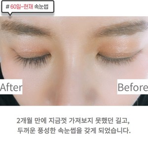 기린아이래쉬 속눈썹영양제 GILYN EYELASH SERUM, 5ml, 1개