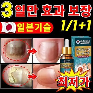 {일본 수입} 100% 두꺼운 손발톱 곰팡이 제거오래된 회색 손톱 제거기타 모든 손톱 트리트먼트 LY023, 2개, 20g