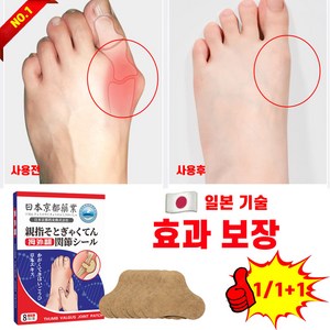 [즉시완화] 1/1+1 일본기술 무지외반증 패치 발가락 손가락 소건막류 관절염 통증 완화 치료 결절 염증 교정 통정 붙이는 파스, 8매입, 1개