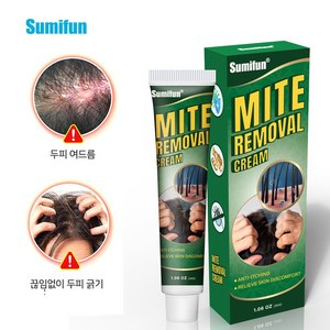 가려움증 두피 모낭염 가려움 방지 연고 20g S-38, 30ml, 2개