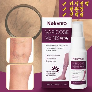 Nekvno 정맥염 스프레이 혈관염 통증완화 촉진하다 혈액순환, 35ml, 1개, 35ml