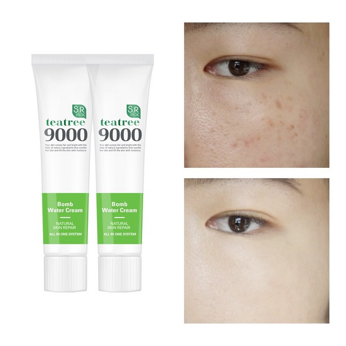 색소토닝크림 기미 잡티 착색 색소침착 검버섯 주근깨 수분 보습 티트리 재생 화이트닝 미백 크림, 2개, 50ml