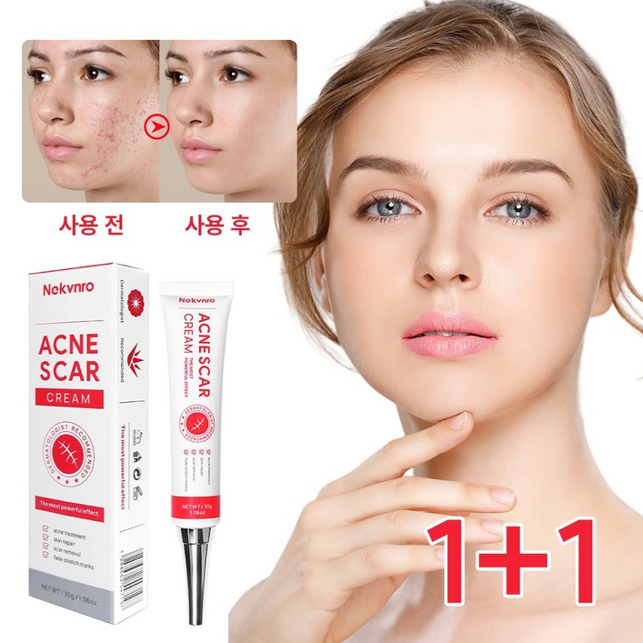 여드름연고 여드름흉터 리페어크림 좁쌀여드름 모낭염 문제피부 케어, 2개, 30g