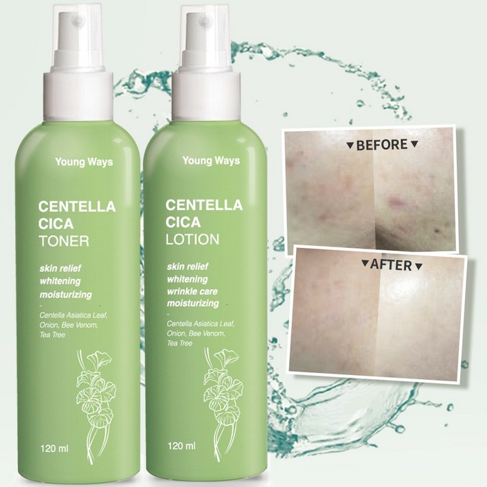 영웨이즈 시카 토너 120ml + 로션 120ml 세트 / 티트리 / 병풀 / 봉독 / 어성초 여드름