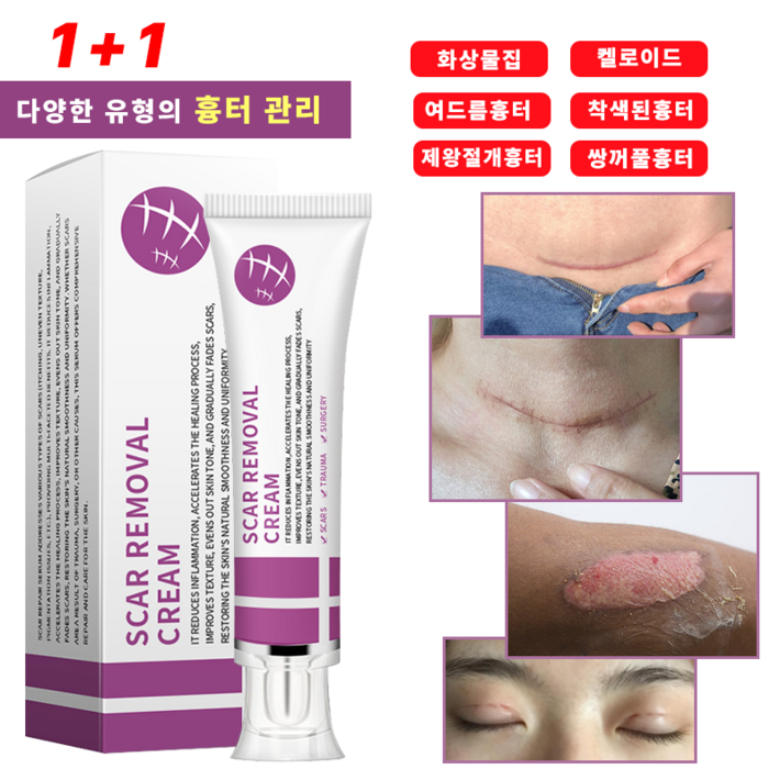 흉터연고 화상연고 상처연고 켈로이드 화상물집 여드름흉터 제왕절개흉터 피부흉터 착색된흉터 비후성 반흔 쌍꺼풀흉터, 30ml, 2개 흉터연고 화상연고 상처연고 켈로이드 화상물집 여드름흉터 제왕절개흉터 피부흉터 착색된흉터 비후성 반흔 쌍꺼풀흉터, 30ml, 2개