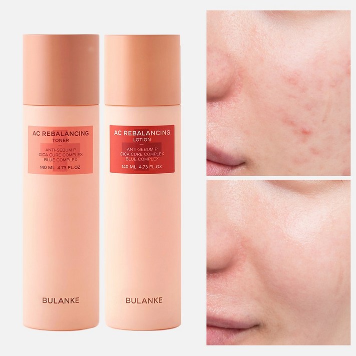 불란케 에이씨 리밸런싱 2종세트 여드름 스킨로션 성인 청소년 민감성 사춘기 기초, 1세트