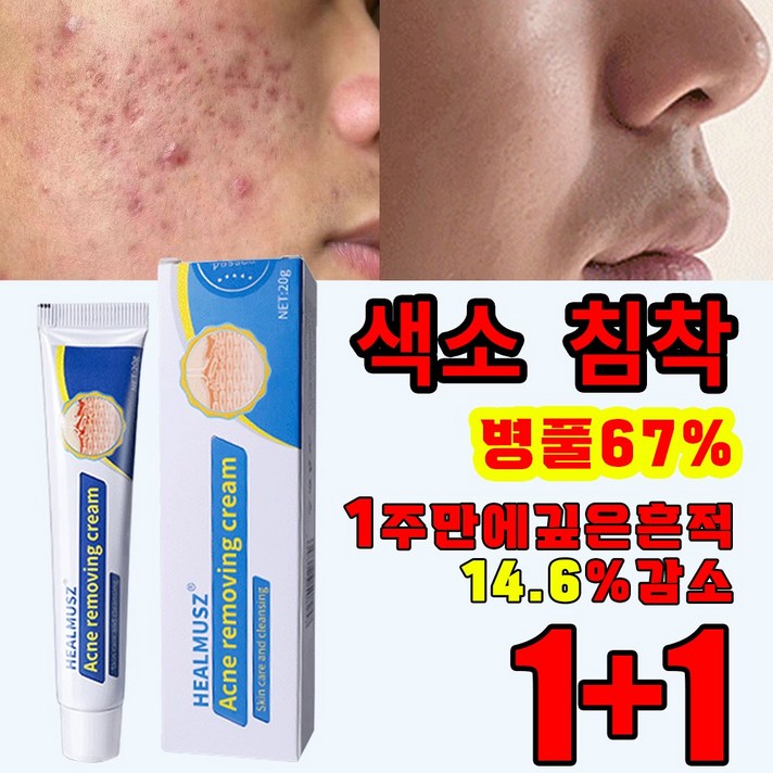 국내배송 병풀추출물 여드름 레티놀 여드름 연고 리페어 연고 진정 피지케어 크림 흉터 치료 자생 관리후 점뺀후 크림 발효 재생크림샤블 나이아신아마이드 레티놀 펩타이드크림, 2개, 20g