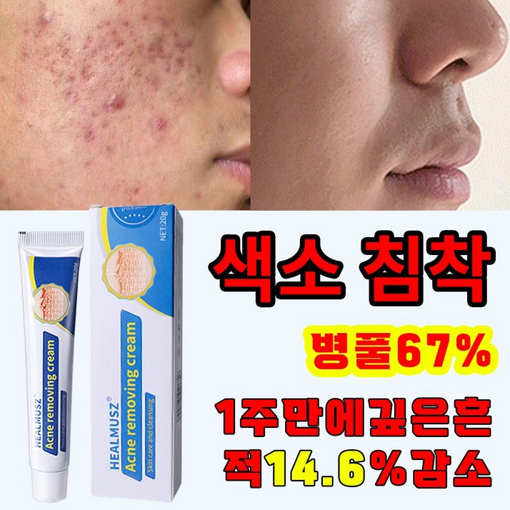 [국내배송] 병풀추출물 여드름 레티놀 여드름 연고 리페어 연고  진정 피지케어 크림 흉터 치료 자생 관리후 점뺀후 크림 발효 재생크림샤블 나이아신아마이드 레티놀 펩타이드크림