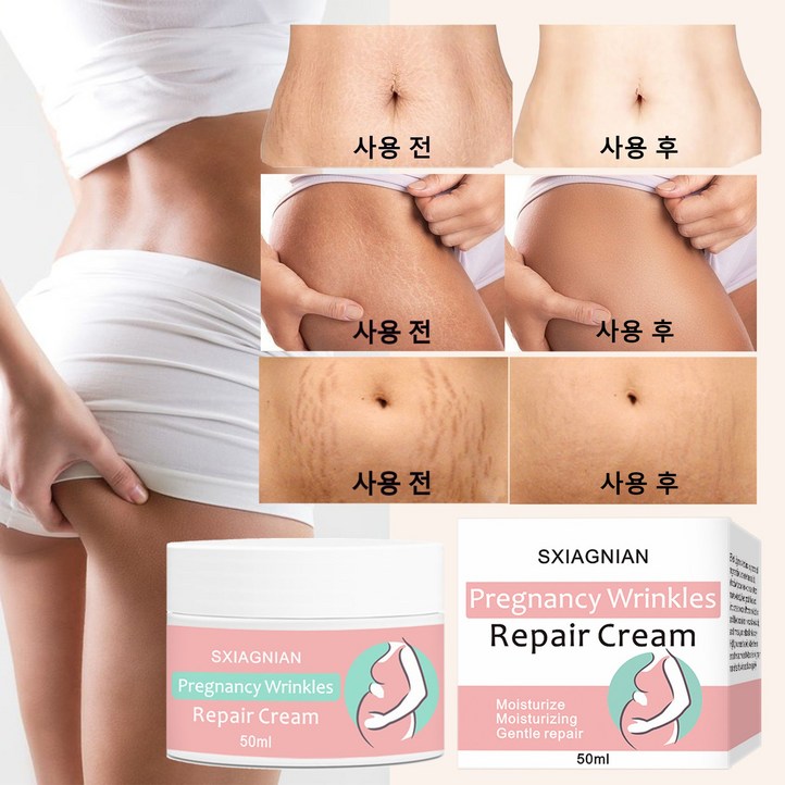 한국셀러본토출하임산부 산전후 튼살 탄력케어 크림 흉터관리 임산부 청소년 이용가능, 2개, 50g